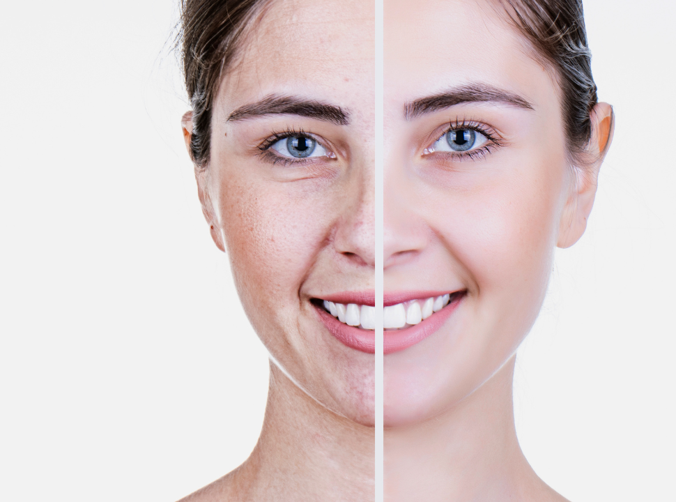 What You Need To Know About Skin Aging Process