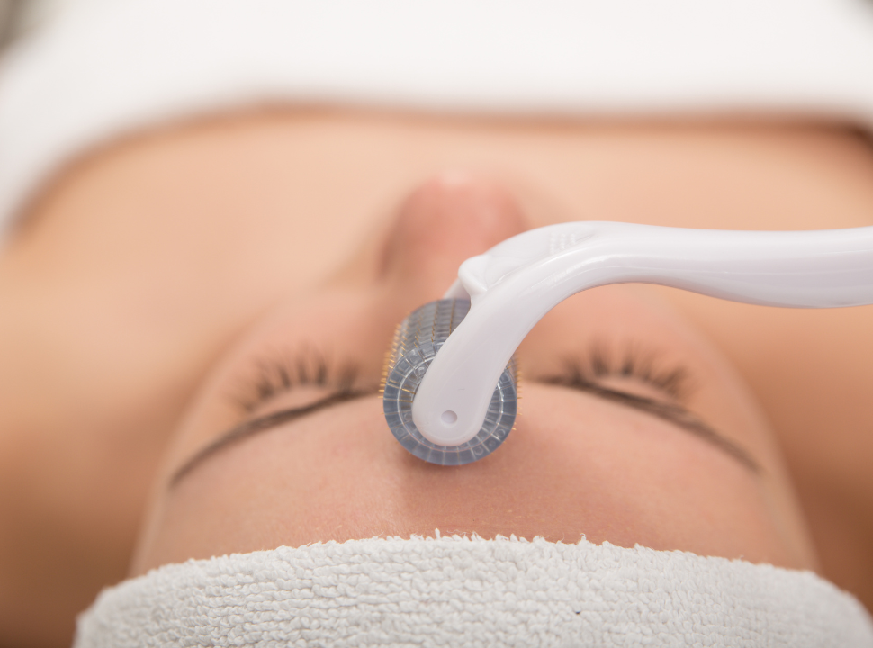 Skincare Tips for Micro-Needling Aftercare